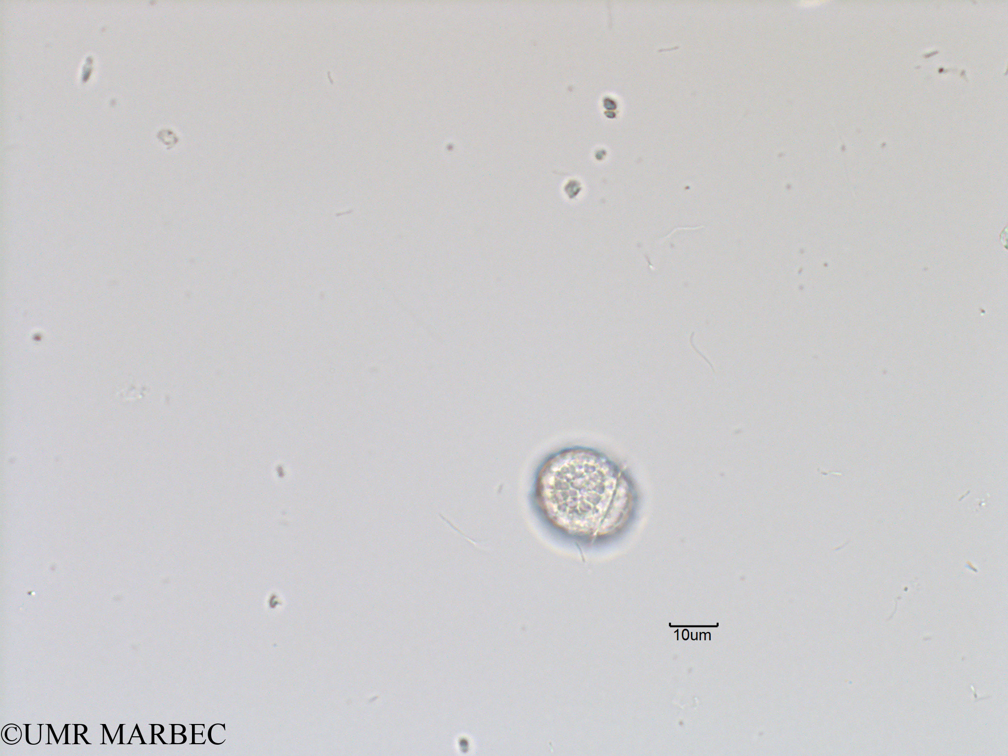 phyto/Bizerte/bizerte_bay/RISCO November 2015/Palaeophalacroma sp (Baie_T5-ACW2-dino à trouver-8).tif(copy).jpg